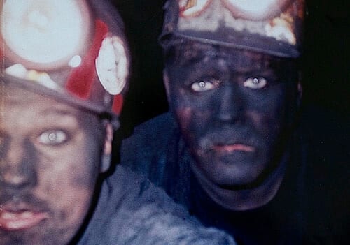 Coalworker’s Pneumoconiosis